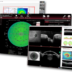 Askin - Heidelberg Engineering - Heyex2