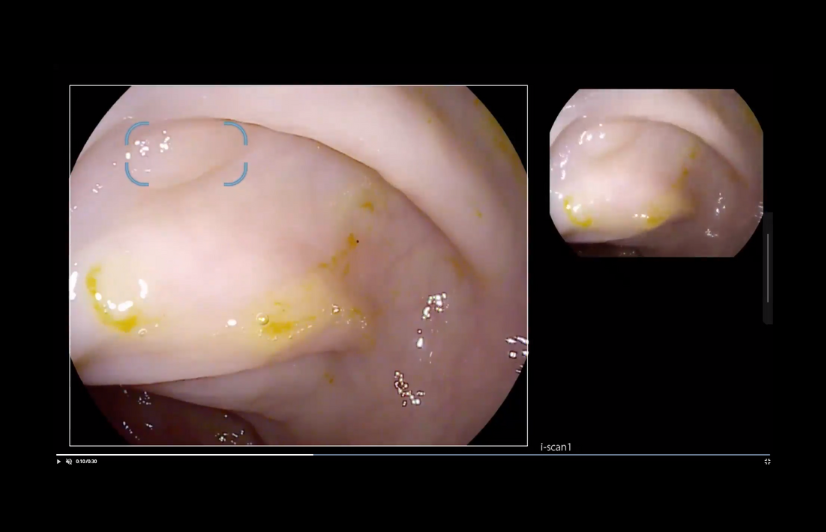 Askin - PENTAX Medical - Discovery